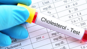 Cholesterol